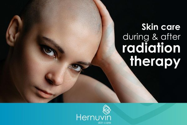 Radiation therapy skin care